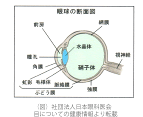 飛蚊症